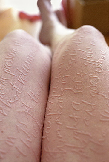 007w1tf2dermatographism.jpg Hosting at Sudaneseonline.com