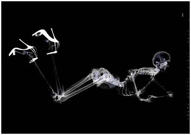 skeliton.GIF Hosting at Sudaneseonline.com