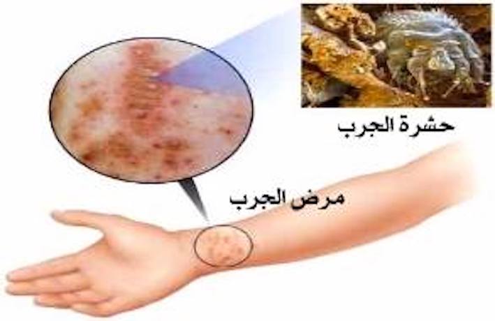 10660195_10152300892291373_8711482864764687218_n1.jpg Hosting at Sudaneseonline.com